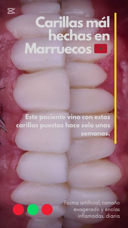 TikTok video thumbnail by cmdentalmarbella