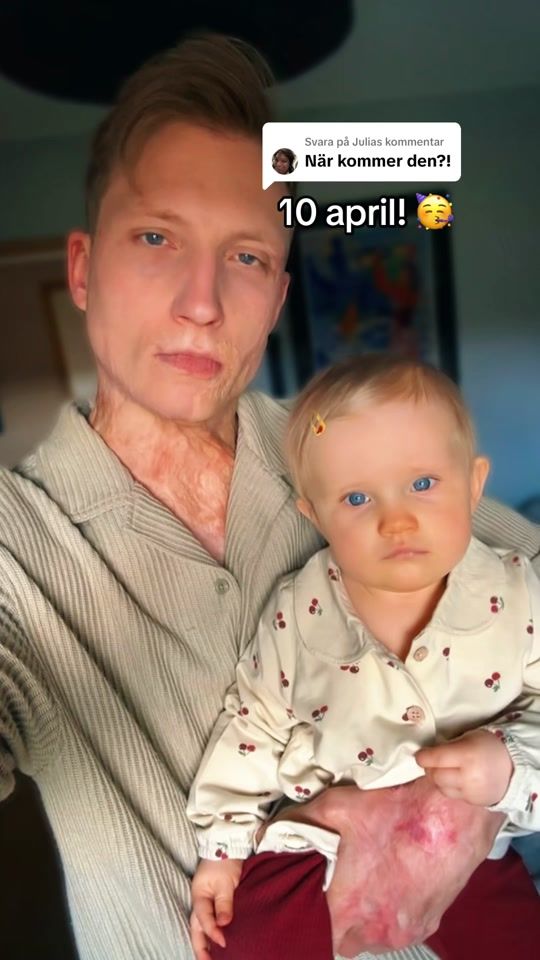 TikTok video thumbnail by axelschylstrom