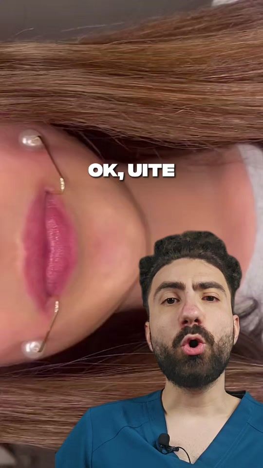 TikTok video thumbnail by dr.teddystroe