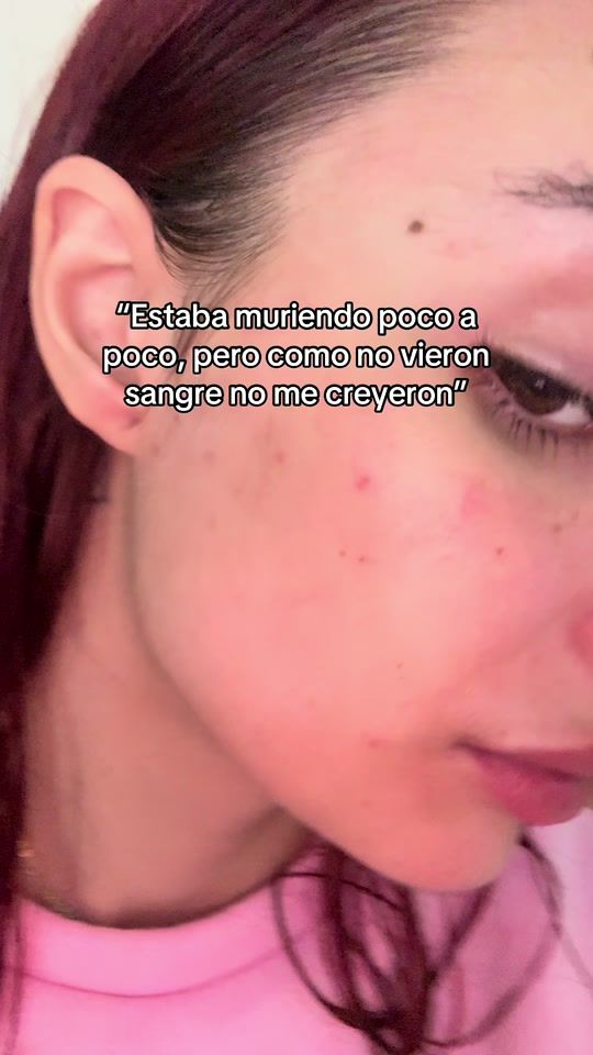 TikTok video thumbnail by alisscoux
