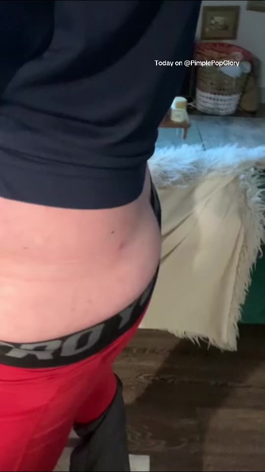 TikTok video thumbnail by pimplepopglory