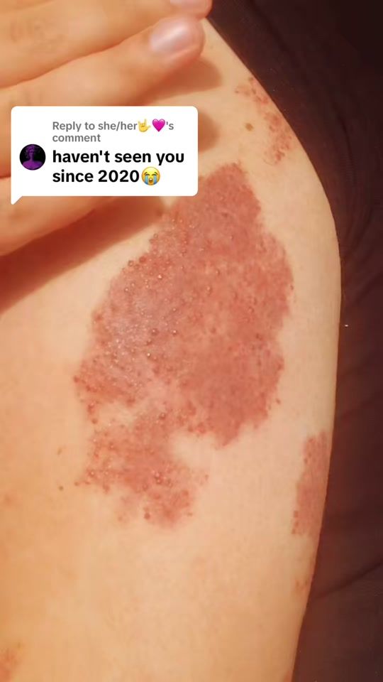 TikTok video thumbnail by robert.ferdos