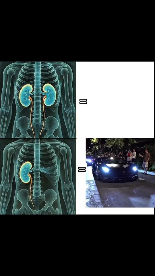 TikTok video thumbnail by beradbacwyc
