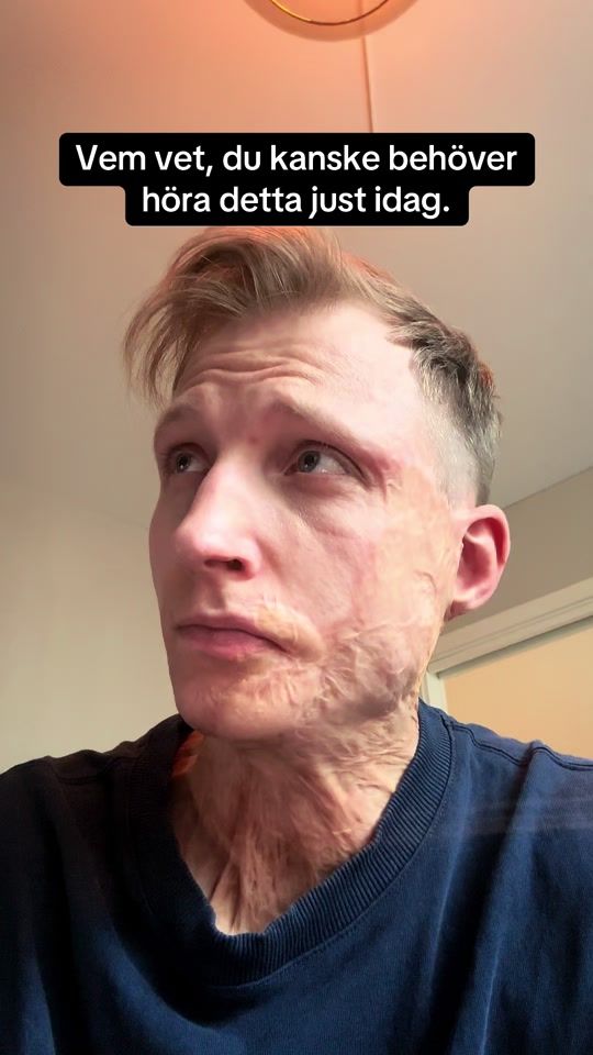 TikTok video thumbnail by axelschylstrom