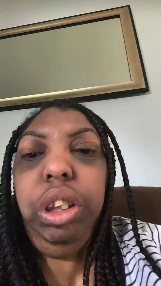 TikTok video thumbnail by che_ppooo