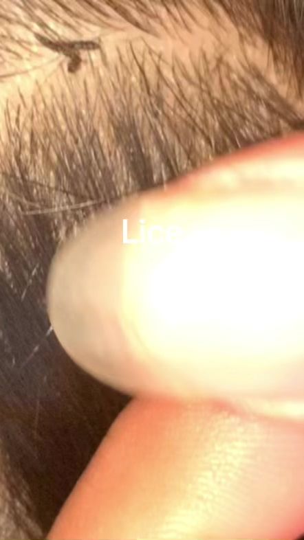 TikTok video thumbnail by licesomany