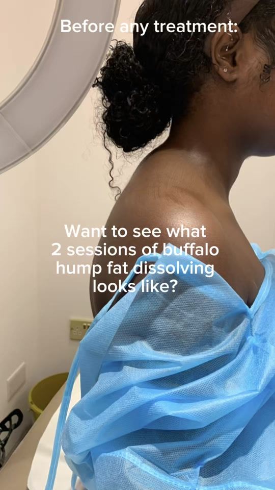 TikTok video thumbnail by as_allure