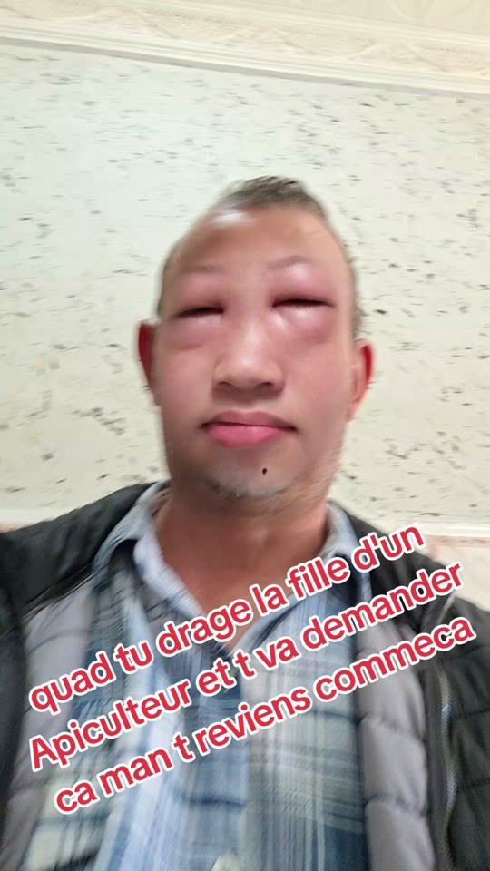 TikTok video thumbnail by jaffarlekabyle