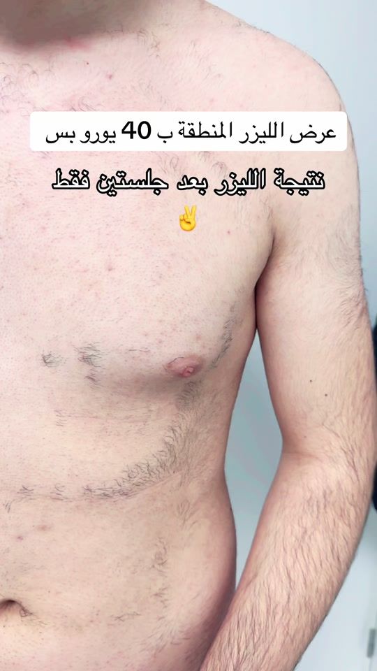 TikTok video thumbnail by moh.alwan