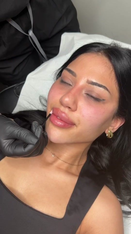 TikTok video thumbnail by xo_clinic