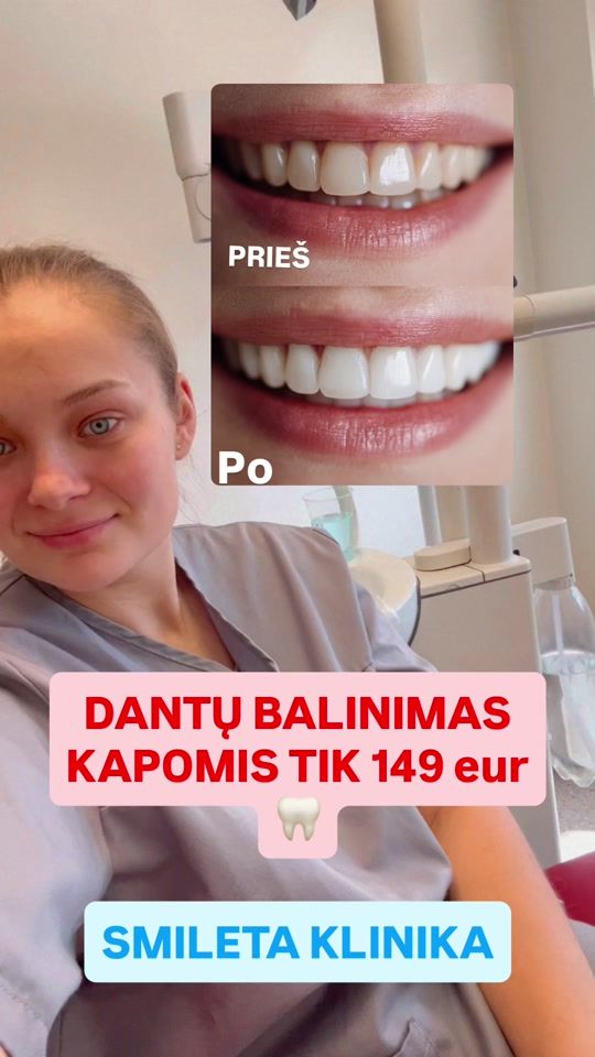 TikTok video thumbnail by stalioraitytej