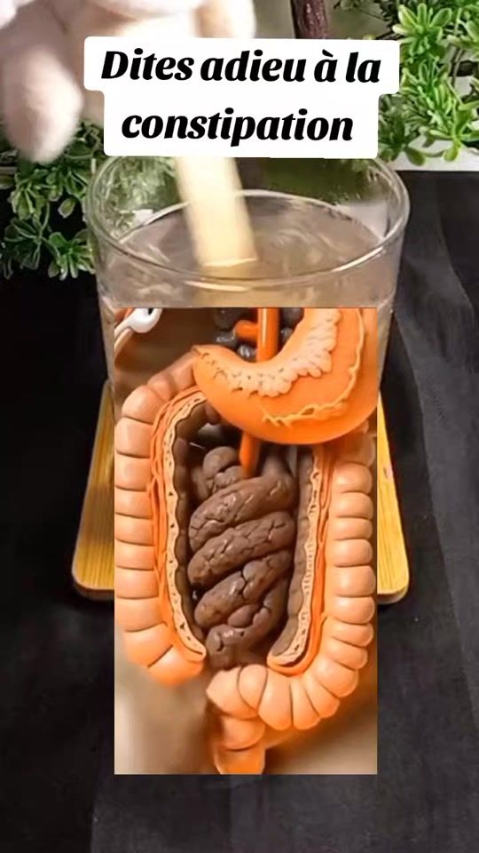 TikTok video thumbnail by docteurr.n