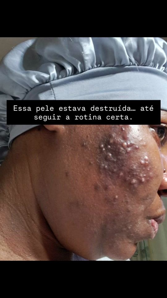 TikTok video thumbnail by .esteticista