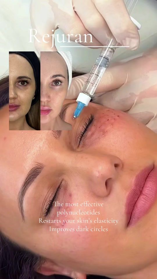 TikTok video thumbnail by aestha_clinic