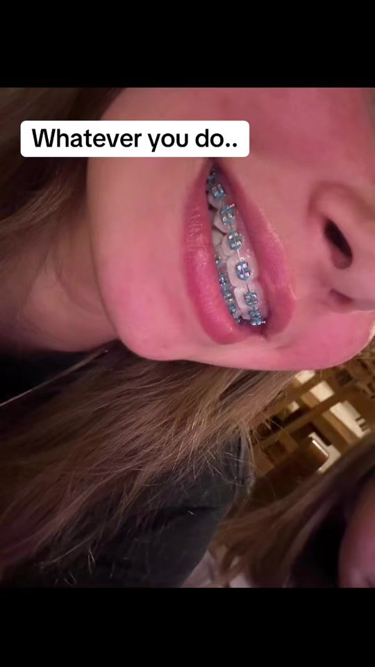 TikTok video thumbnail by get_braces