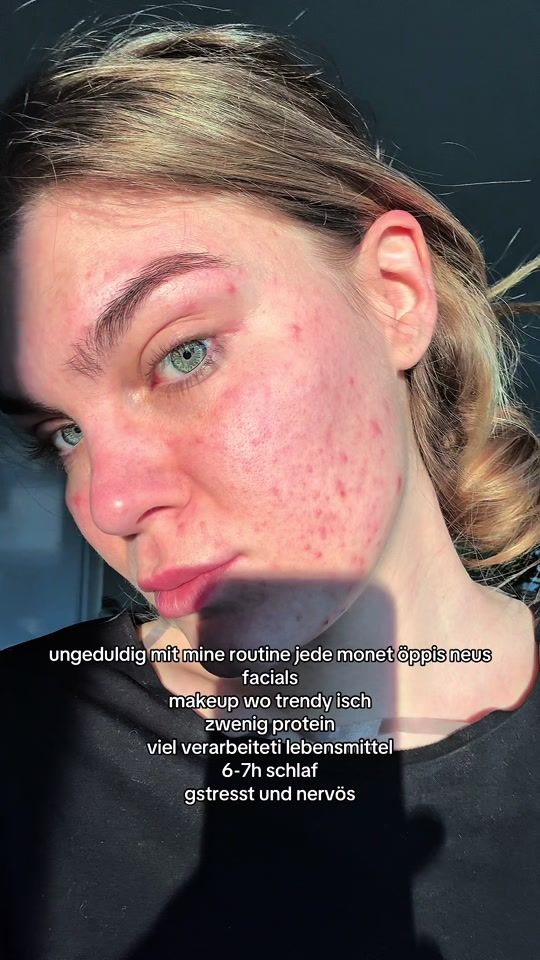 TikTok video thumbnail by laupatrice