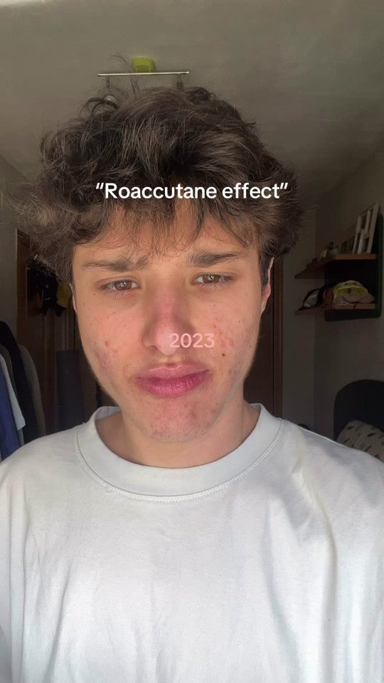 TikTok video thumbnail by albeertobrown