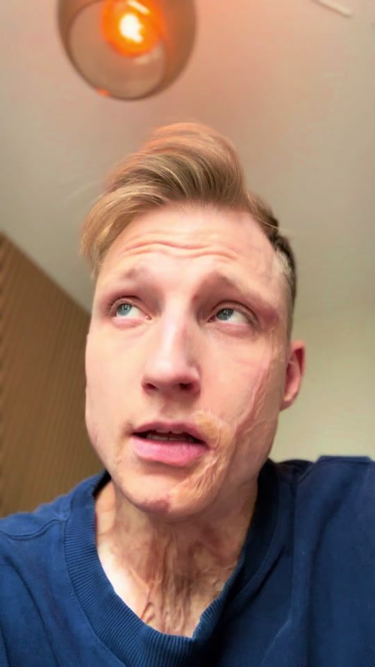TikTok video thumbnail by axelschylstrom