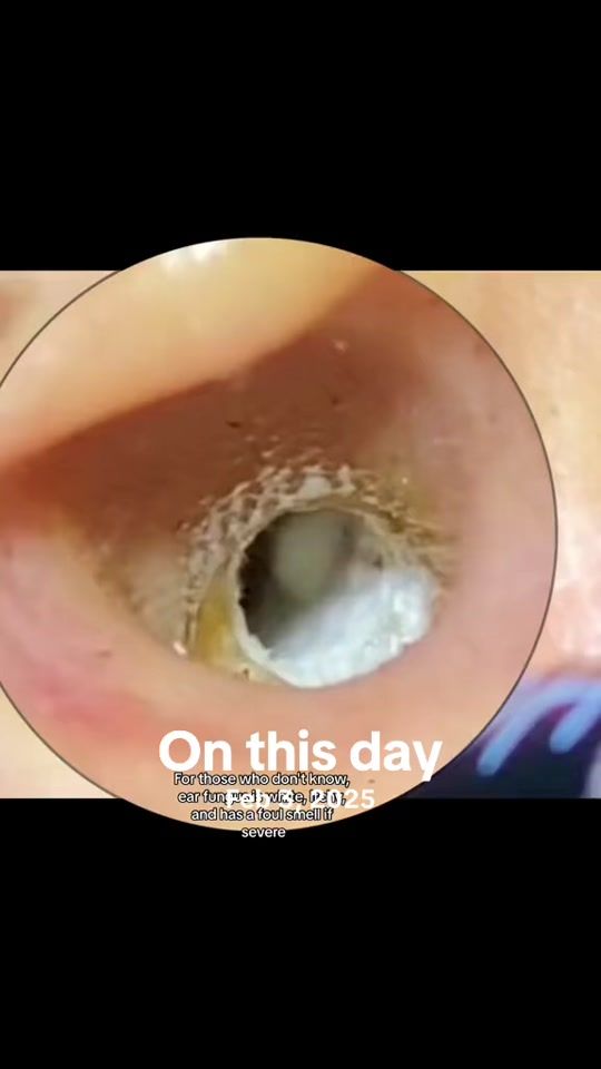 TikTok video thumbnail by ohmygood116