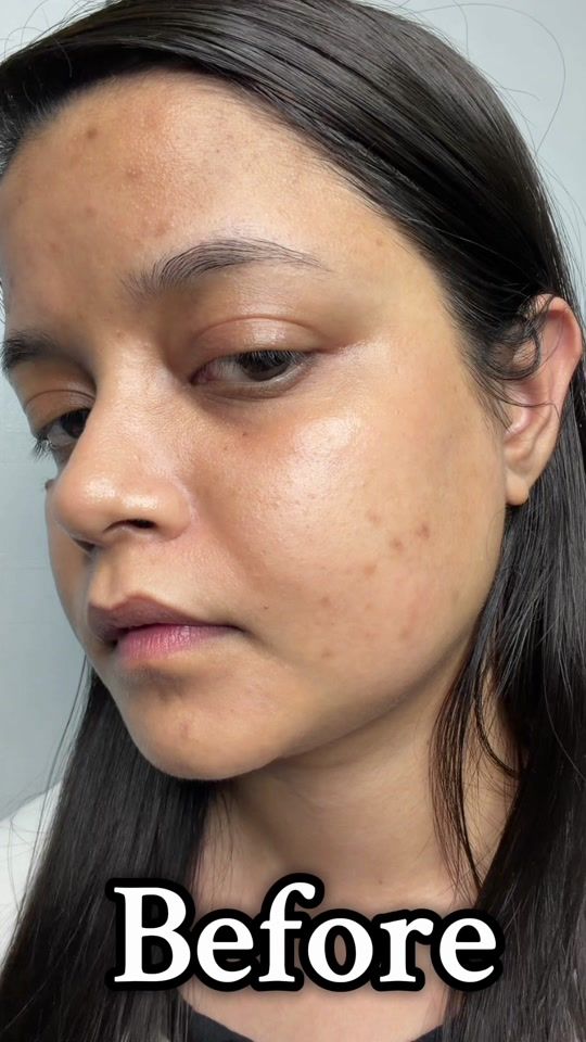 TikTok video thumbnail by skincarebytatari