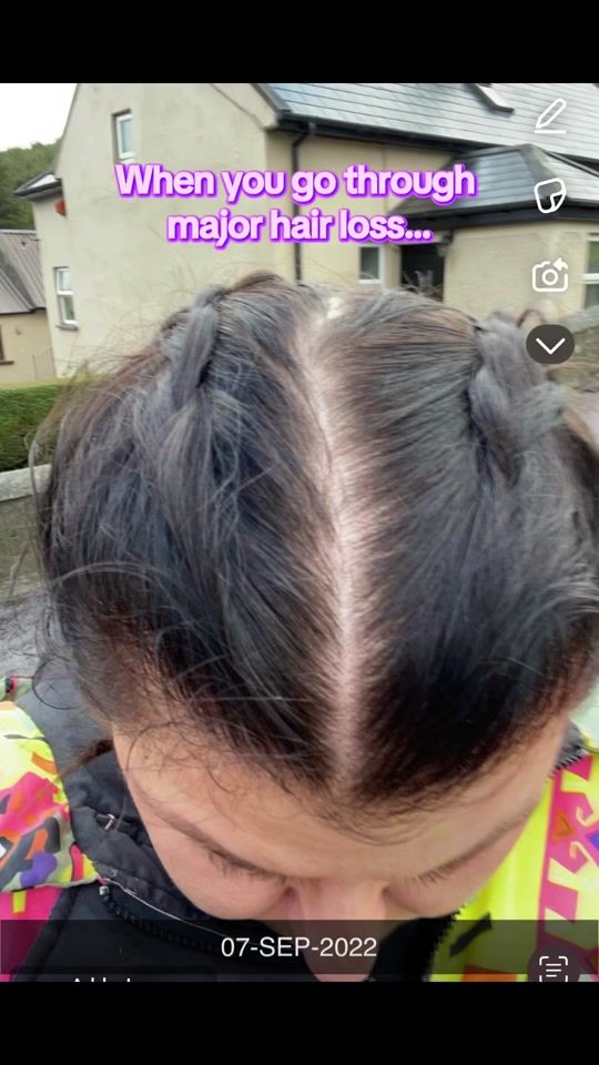 TikTok video thumbnail by healthy.hair.fairy