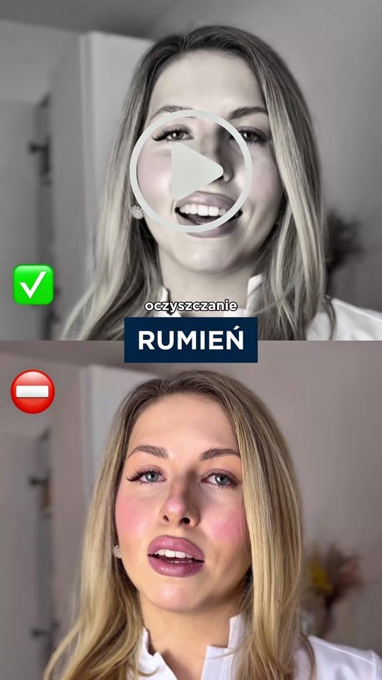 TikTok video thumbnail by bioderma_polska