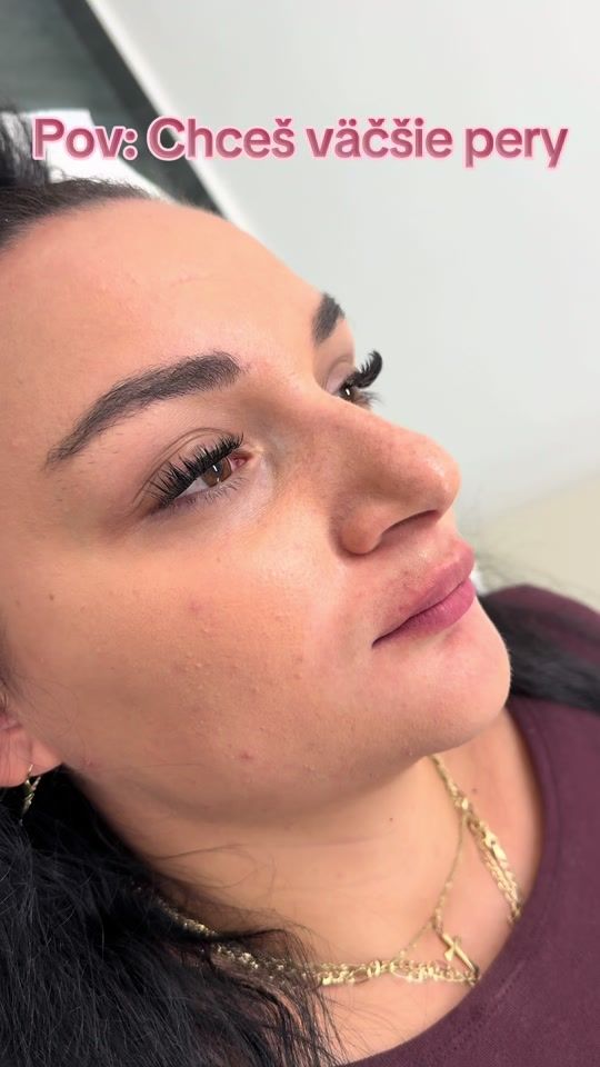 TikTok video thumbnail by sk.clinic
