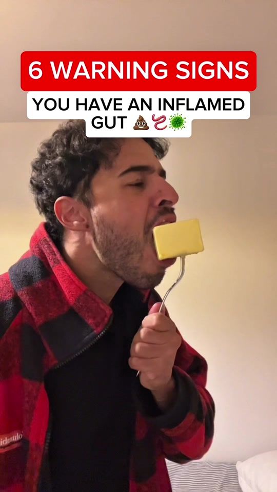 TikTok video thumbnail by yousefkoptimise