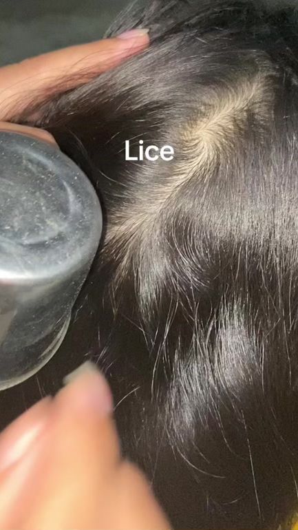 TikTok video thumbnail by licesomany