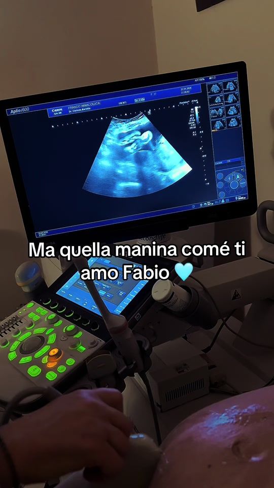 TikTok video thumbnail by tittafranco