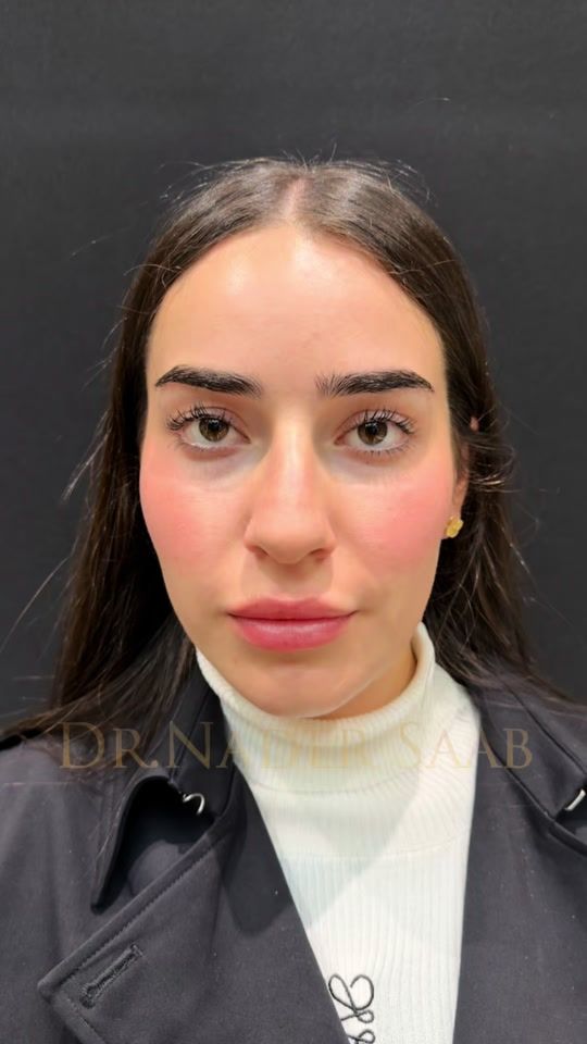 TikTok video thumbnail by drnadersaab