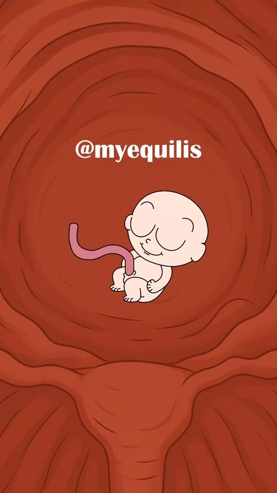 TikTok video thumbnail by myequilis