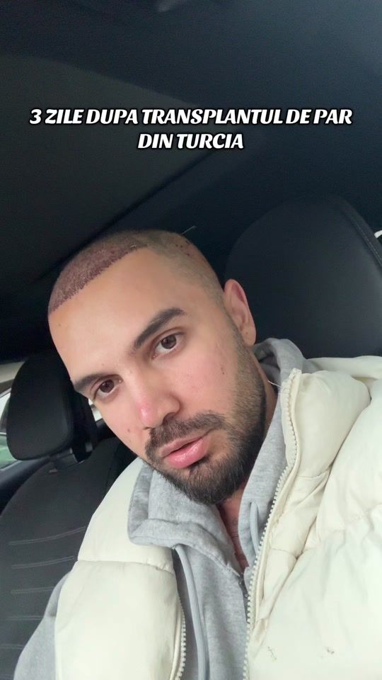 TikTok video thumbnail by ionutdima