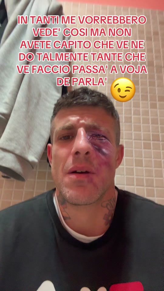 TikTok video thumbnail by .damianodiegojunior