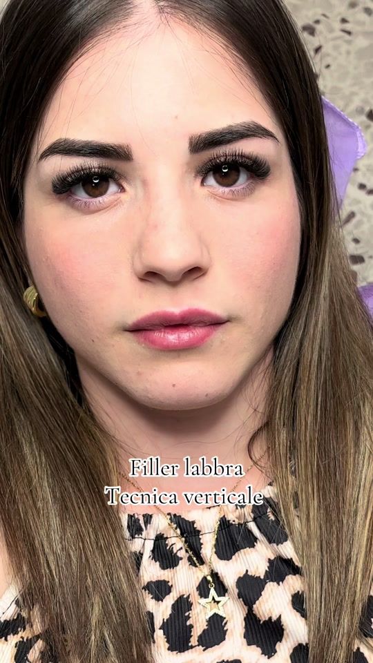 TikTok video thumbnail by dott.valentino_di_mauro