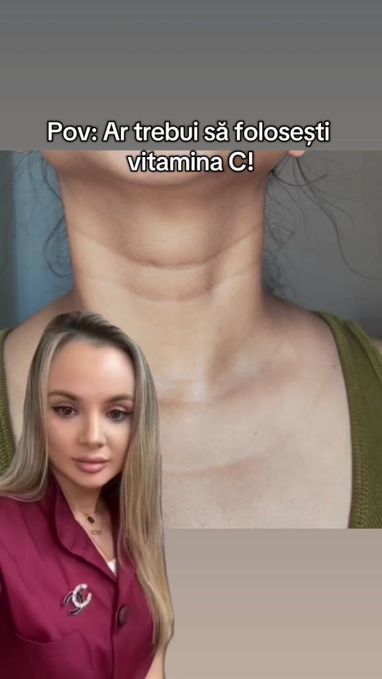 TikTok video thumbnail by dr.ralucaharnagea