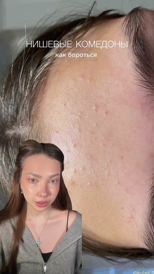 TikTok video thumbnail by alenril