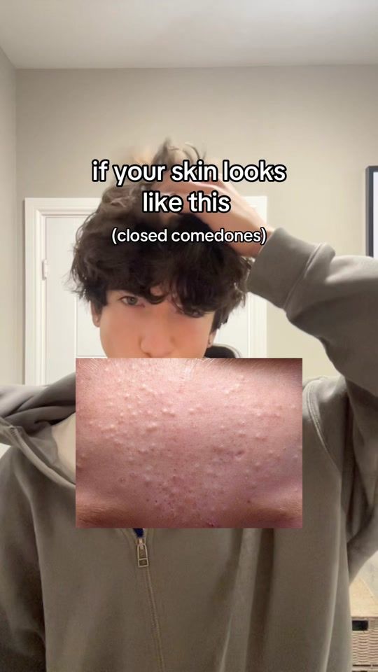 TikTok video thumbnail by coleglos
