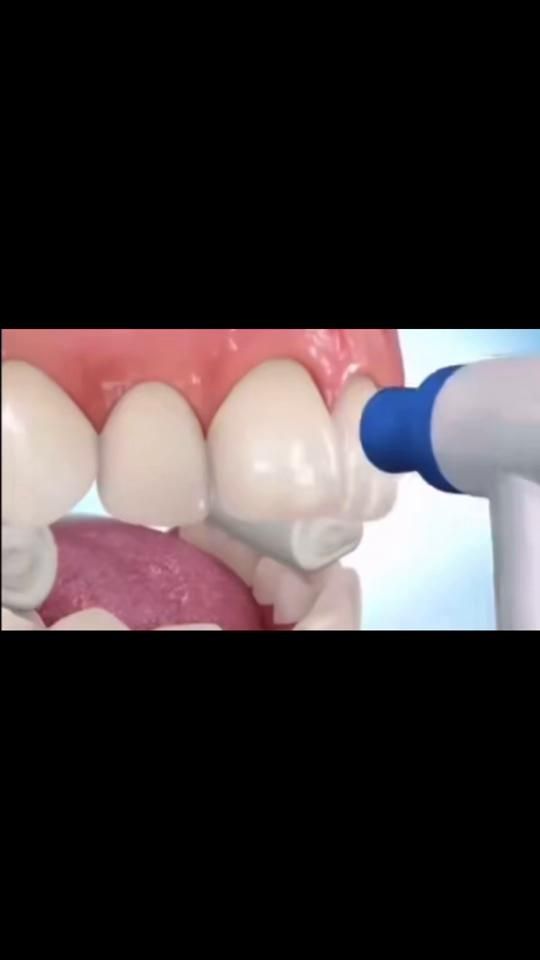 TikTok video thumbnail by miku_noodle