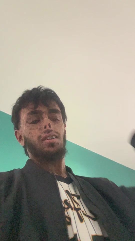 TikTok video thumbnail by aabde.i