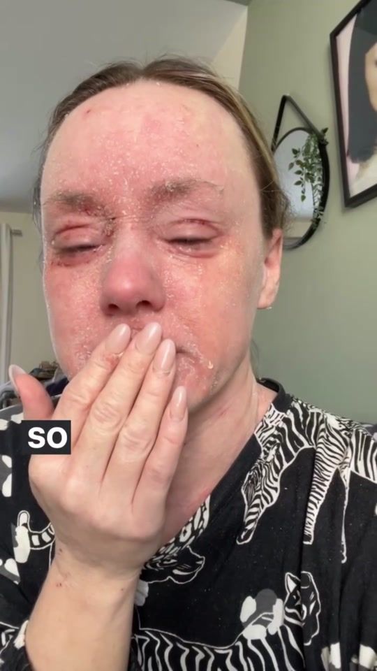 TikTok video thumbnail by bee.thebrave