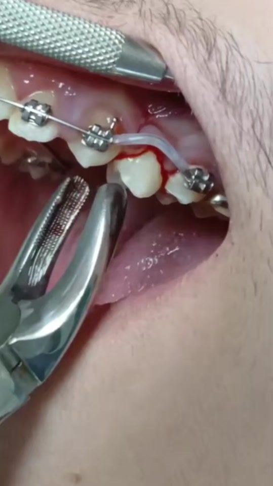 TikTok video thumbnail by aerdnailosnoc