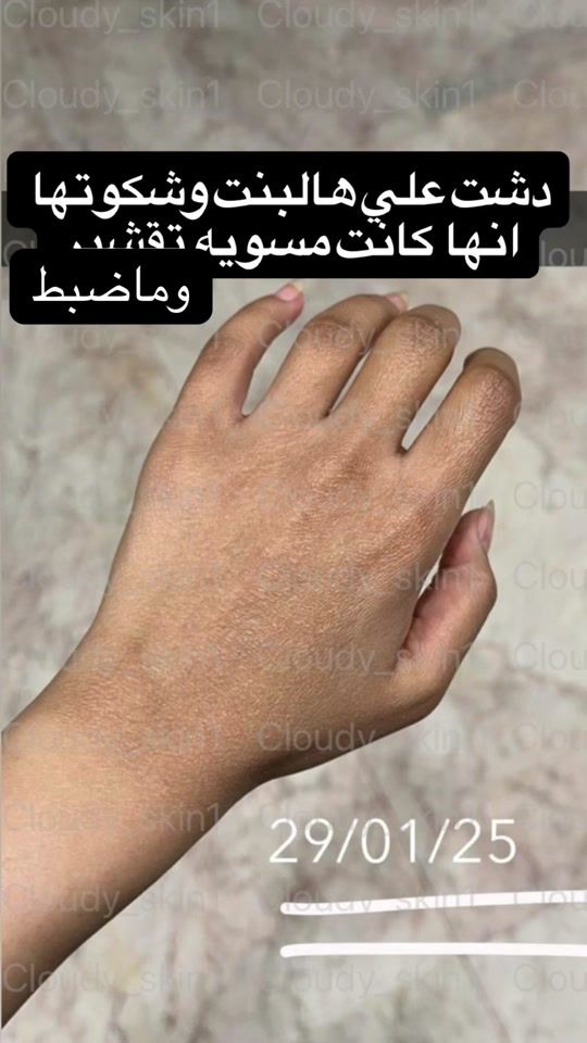 TikTok video thumbnail by cloudy_skin1