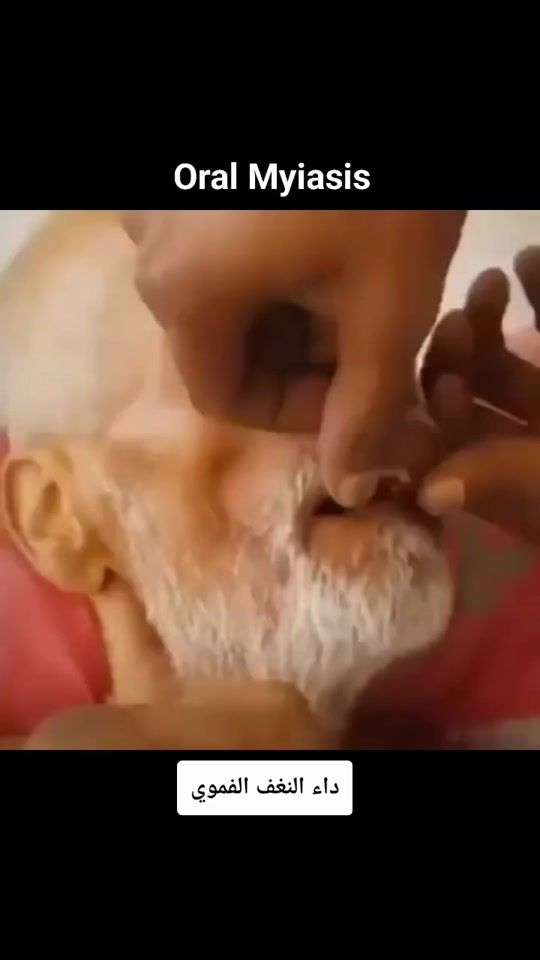 TikTok video thumbnail by dentist.samer.akkad