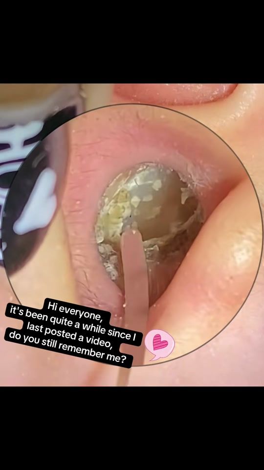 TikTok video thumbnail by ohmygood116