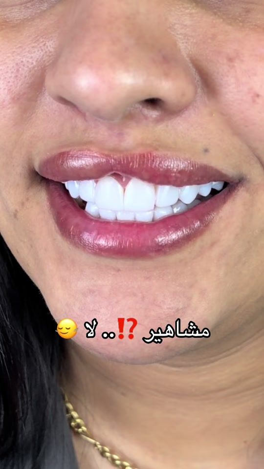 TikTok video thumbnail by dr.berrani_chahra
