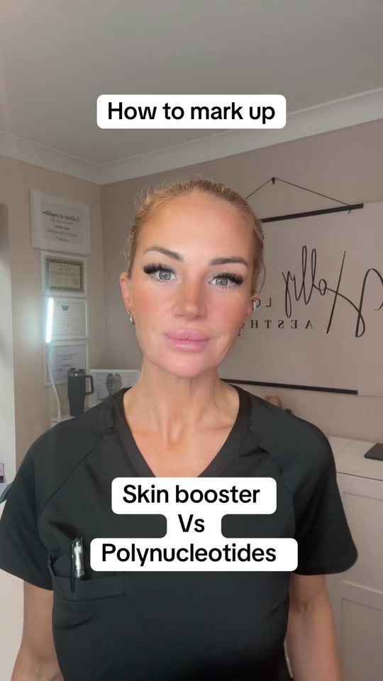 TikTok video thumbnail by hollylouiseaesthetics