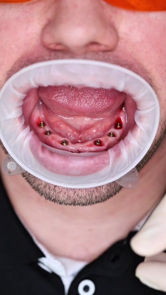 TikTok video thumbnail by dsmile.cz