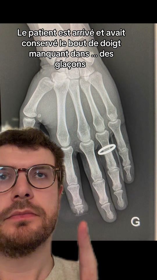 TikTok video thumbnail by docteurpgr