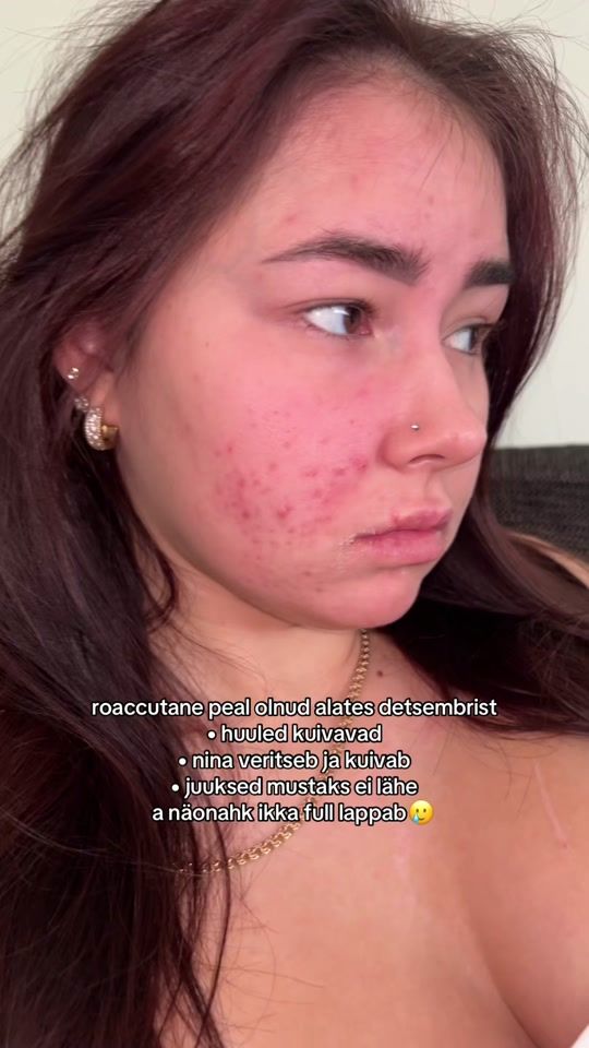 TikTok video thumbnail by laurakiisk